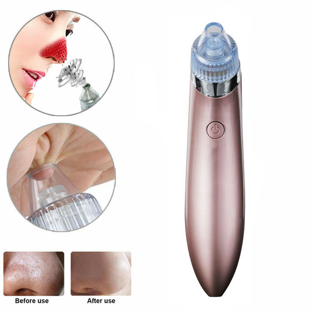 Electric Blackhead Vacuum Pore Cleaner, Acne Pimple Remover Strong Suction Tool