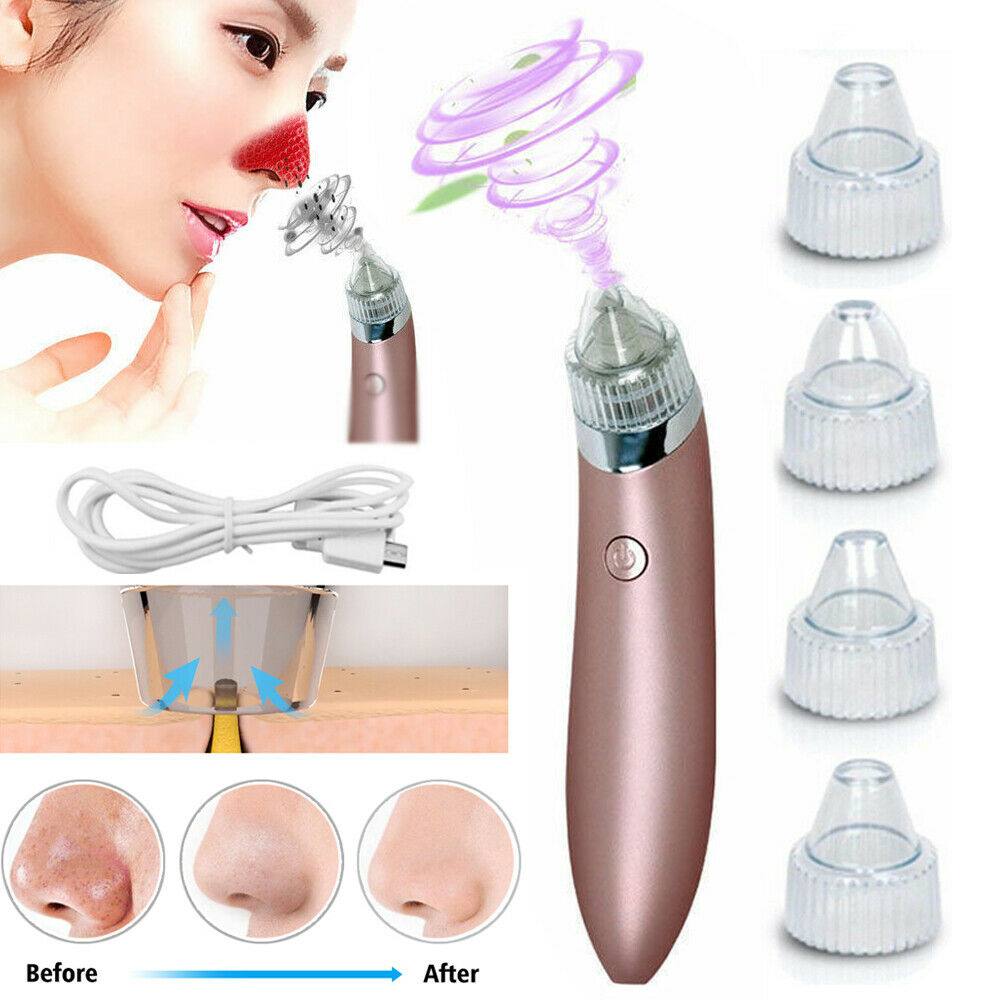 Electric Blackhead Vacuum Pore Cleaner, Acne Pimple Remover Strong Suction Tool