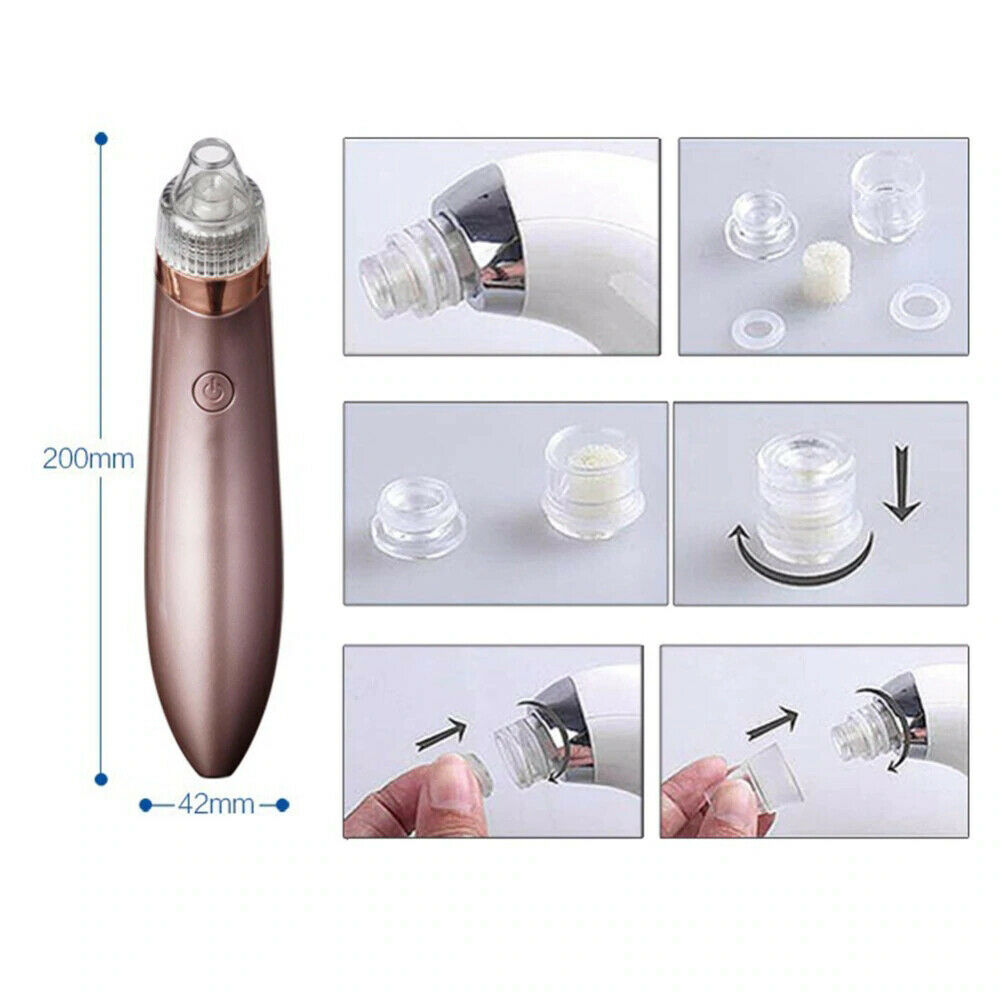 Electric Blackhead Vacuum Pore Cleaner, Acne Pimple Remover Strong Suction Tool